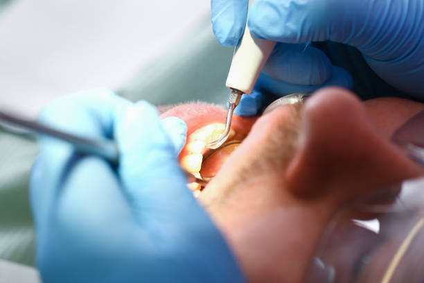 Best Tooth Infection Emergency Dentist  in Seabrook, MD