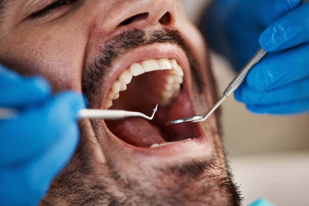 Best Urgent Tooth Repair  in Seabrook, MD